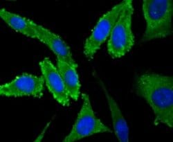 Nav1.7 Rabbit anti-Human, Polyclonal, Novus Biologicals 100 &mu;l; Unconjugated:Antibodies,