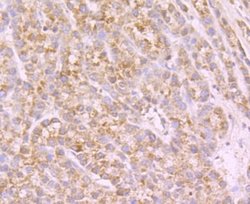 Nav1.7 Rabbit anti-Human, Polyclonal, Novus Biologicals 100 &mu;l; Unconjugated:Antibodies,