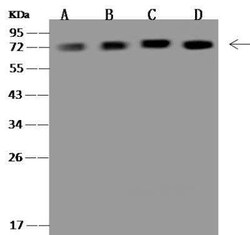 Ndufs1 Antibody, Novus Biologicals 100 &mu;g; Unconjugated:Antibodies,
