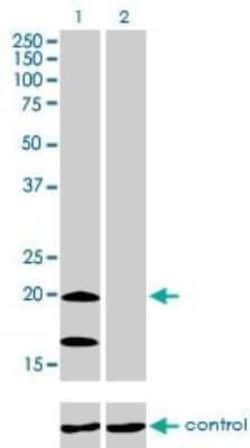 Ndufs4 Antibody (1A1), Novus Biologicals 0.1 mg, Unconjugated:Antibodies,
