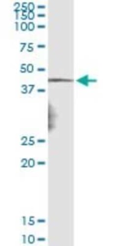 Necdin Antibody (3B9), Novus Biologicals 0.1 mg | Buy Online | Novus Biologicals | Fisher Scientific