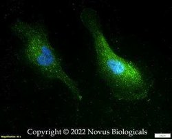 Nephrin Antibody, Novus Biologicals 0.1 mg; Unconjugated:Antibodies, Polyclonal