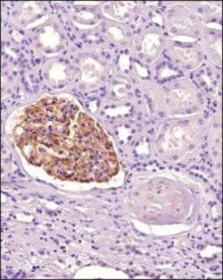 Nephrin Antibody, Novus Biologicals 0.1 mg; Unconjugated:Antibodies, Polyclonal