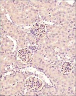 Nephrin Antibody, Novus Biologicals 0.1 mg; Unconjugated:Antibodies, Polyclonal
