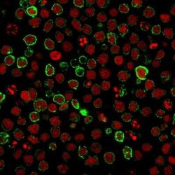 Neprilysin/CD10 Antibody (FR4D11), Novus Biologicals:Antibodies:Primary