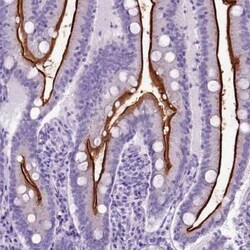Neprilysin/CD10 Antibody, Novus Biologicals 25 &mu;L, Unconjugated:Antibodies,