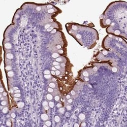 Neprilysin/CD10 Antibody, Novus Biologicals 25 &mu;L, Unconjugated:Antibodies,