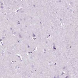 Neprilysin/CD10 Antibody, Novus Biologicals 25 &mu;L, Unconjugated:Antibodies,