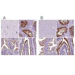 Neprilysin/CD10 Antibody, Novus Biologicals 25 &mu;L, Unconjugated:Antibodies,