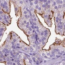 Neprilysin/CD10 Antibody, Novus Biologicals 25 &mu;L, Unconjugated:Antibodies,