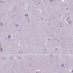 Neprilysin/CD10 Antibody, Novus Biologicals 25 &mu;L, Unconjugated:Antibodies,