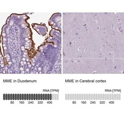 Neprilysin/CD10 Antibody, Novus Biologicals 25 &mu;L, Unconjugated:Antibodies,
