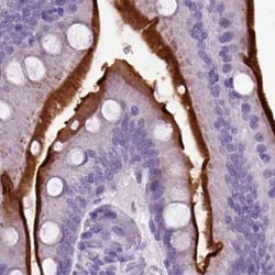 Neprilysin/CD10 Antibody, Novus Biologicals 25 &mu;L, Unconjugated:Antibodies,