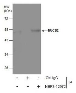 Nesfatin-1/Nucleobindin-2 Antibody, Novus Biologicals 100 &mu;g | Buy Online | Bio-Techne | Fisher Scientific