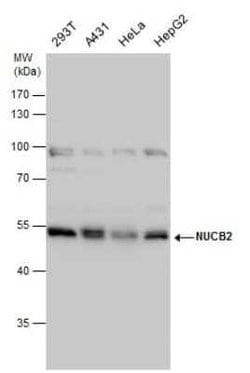 Nesfatin-1/Nucleobindin-2 Antibody, Novus Biologicals 100 &mu;g | Buy Online | Bio-Techne | Fisher Scientific