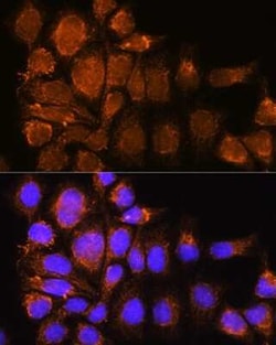 Nesprin-3 Antibody - Azide and BSA Free, Novus Biologicals 0.02 mL; Unconjugated:Antibodies