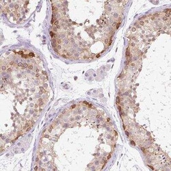 Nesprin-3 Antibody, Novus Biologicals 25 &mu;L, Unconjugated:Antibodies,