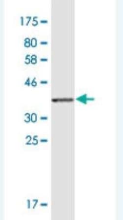 Netrin-1 Antibody (5H8), Novus Biologicals 0.1 mg | Buy Online | Novus Biologicals | Fisher Scientific
