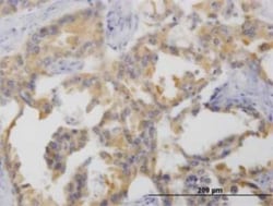 Netrin G2 Antibody (4F11), Novus Biologicals 0.1 mg | Buy Online | Novus Biologicals | Fisher Scientific