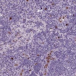 Netrin G2 Antibody, Novus Biologicals:Antibodies:Primary Antibodies