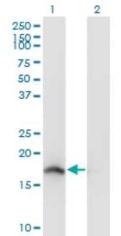 Neudesin Antibody (7D10), Novus Biologicals 0.1 mg | Buy Online | Novus Biologicals | Fisher Scientific