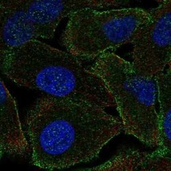 Neurabin 1 Antibody, Novus Biologicals 100 &mu;g | Buy Online | Novus Biologicals | Fisher Scientific