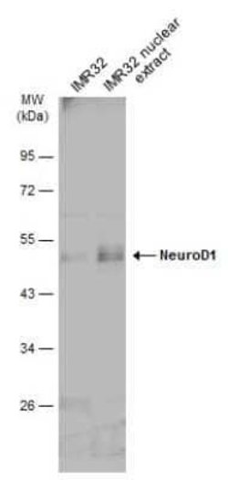 NeuroD1 Antibody, Novus Biologicals 100 &mu;g | Buy Online | Novus Biologicals | Fisher Scientific