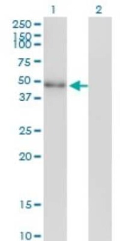 Novus Biologicals NeuroD2 Antibody (3E7), Novus Biologicals 0.1 mg | Buy Online | Novus Biologicals&trade; | Fisher Scientific