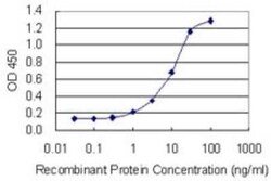 Neurobeachin Antibody (3F11), Novus Biologicals 0.1 mg | Buy Online | Novus Biologicals | Fisher Scientific