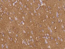 Neurocan Antibody, Novus Biologicals 100 &mu;g | Buy Online | Novus Biologicals | Fisher Scientific