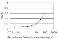 Neurogenin-2 Antibody (1B2), Novus Biologicals 0.1 mg | Buy Online | Novus Biologicals | Fisher Scientific