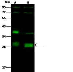 Neurogenin-2 Antibody, Novus Biologicals 100 &mu;g, Unconjugated:Antibodies,