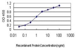 Neuroglobin Antibody (2B5-A7), Novus Biologicals 0.1 mg | Buy Online | Novus Biologicals | Fisher Scientific