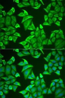 Neuroglobin Antibody - Azide and BSA Free, Novus Biologicals 0.02 mL; Unconjugated:Antibodies,