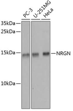 Neurogranin Antibody - BSA Free, Novus Biologicals 0.1 mL | Buy Online | Novus Biologicals | Fisher Scientific