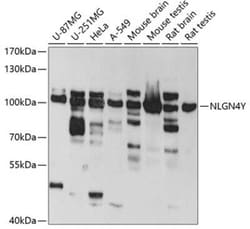 Neuroligin 4Y/NLGN4Y Antibody - BSA Free, Novus Biologicals 0.02 mL, Unconjugated:Antibodies,