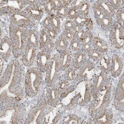 Neurolysin Antibody, Novus Biologicals 25 &mu;L | Buy Online | Novus Biologicals | Fisher Scientific
