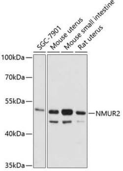 Neuromedin UR2/NMUR2 Antibody - Azide and BSA Free, Novus Biologicals 0.1