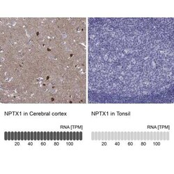 Neuronal Pentraxin 1 Antibody, Novus Biologicals 25ul; Unconjugated:Antibodies,