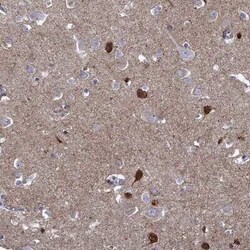 Neuronal Pentraxin 1 Antibody, Novus Biologicals 25ul; Unconjugated:Antibodies,