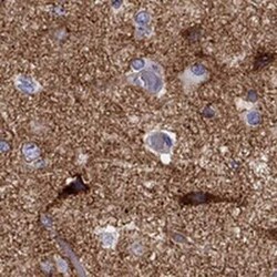 Neuronal Pentraxin 1 Antibody, Novus Biologicals 25ul; Unconjugated:Antibodies,