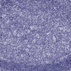 Neuronal Pentraxin 1 Antibody, Novus Biologicals 25ul; Unconjugated:Antibodies,
