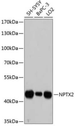 Neuronal Pentraxin 2 Antibody - Azide and BSA Free, Novus Biologicals 0.1