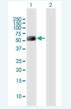 Neuronal Pentraxin R/NPTXR Antibody, Novus Biologicals 50 &mu;g | Buy Online | Novus Biologicals | Fisher Scientific