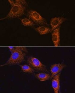 Neuropeptide B Antibody - Azide and BSA Free, Novus Biologicals:Antibodies:Primary