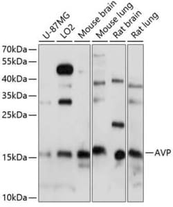Neurophysin II/Arg-vasopressin Antibody - Azide and BSA Free, Novus Biologicals