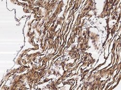 Neuropilin-1 Rabbit anti-Human, Clone: 42, Novus Biologicals 50 &mu;g;