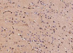 Neuropilin-1 Rabbit anti-Human, Clone: 42, Novus Biologicals 50 &mu;g;