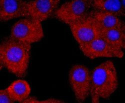 Neutrophil Elastase/ELA2 Rabbit anti-Human, Mouse, Clone: JF098-6, Novus