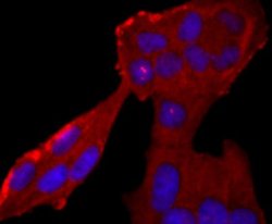 Neutrophil Elastase/ELA2 Rabbit anti-Human, Mouse, Clone: JF098-6, Novus